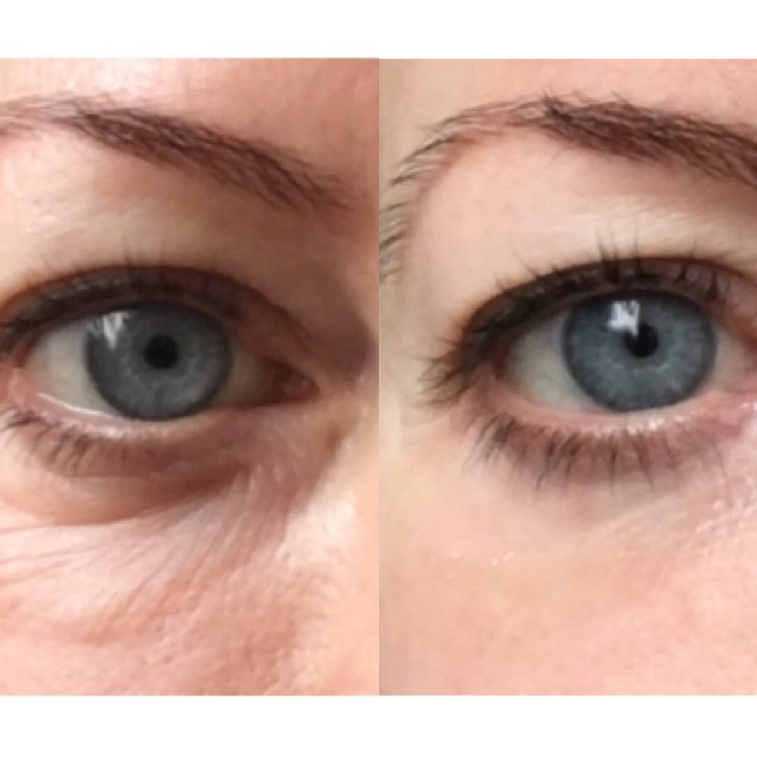 Under Eye Skincare Wand