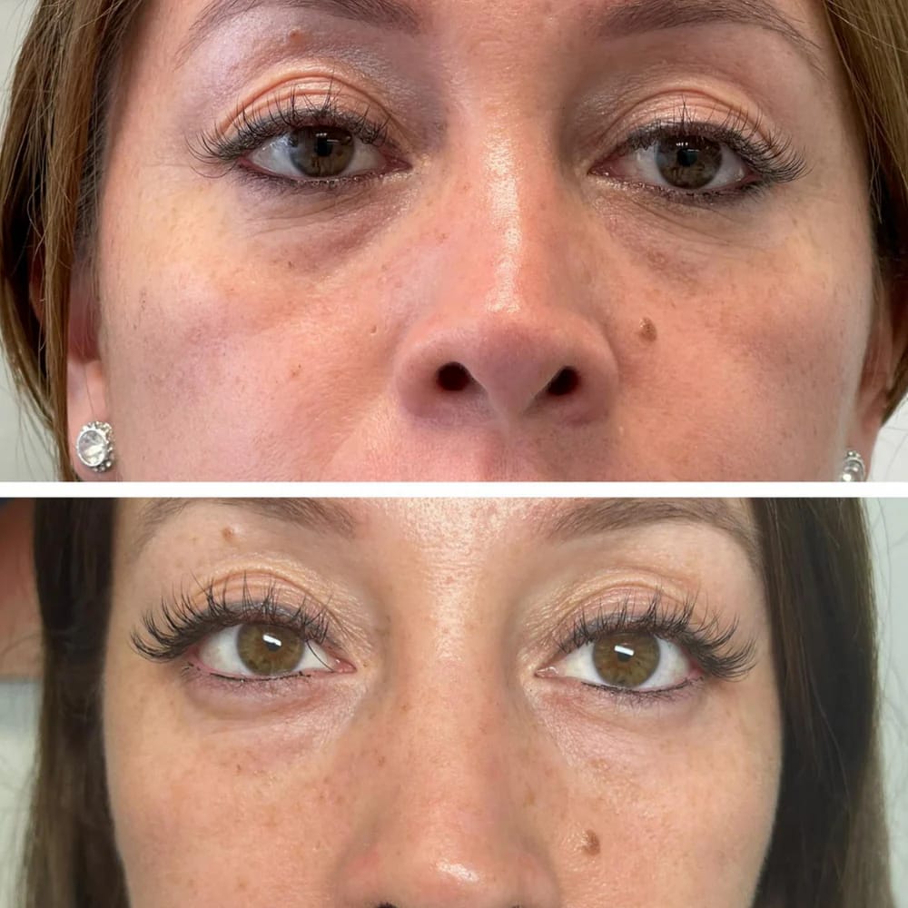 Under Eye Skincare Wand